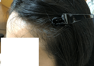 30代女性の治療後の姿