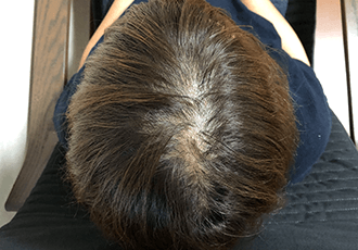 40代女性の治療後の姿