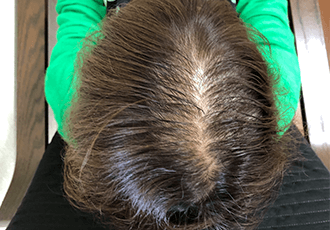 40代女性の治療前の姿