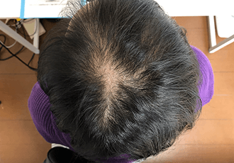 60代女性の治療前の姿